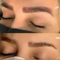 ریموو تخصصی   فیبروز و میکروابرو شیدینگ لب  آموزش
