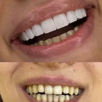 تخفیفات ویژه دندانپزشکی