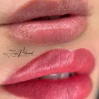 تخفیف ویژه میکروبلیدینگ (فیبروز )