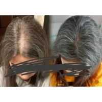 بازگشت پر پشتی مو