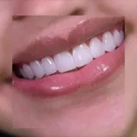 کلیه خدمات دندانپزشکی با *اقساط استثنایی*