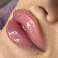 آفر ویژه ژل و بوتاکس کانتورینگ فول فیس