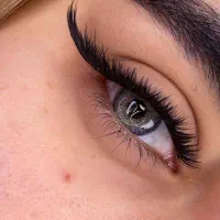 تخفیف ویژه کاشت هیدن