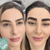 ۷۰٪تخفیف،میکروبلیدینگ ابروبااستادومدرس هانی تبریزی