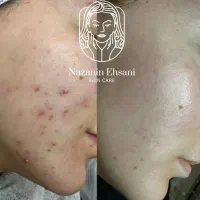 آموزش و خدمات فیشال تخصصی پوست