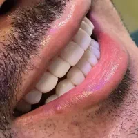 دندانپزشکی درمانی و زیبایی(نقدواقساط)