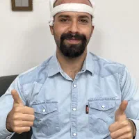 کاشت تخصصی مو ابرو ریش