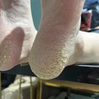 خدمات پدیکور و ناخن