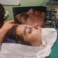 جراحی زیبایی بینی و پلک با تکنیک بدون تامپون