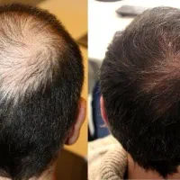 موی پرپشت اعتماد به نفس میده