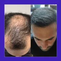 موهات دست ماست