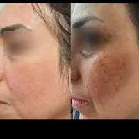 پوست|آرایشی، بهداشتی، درمانی|لردگان, |دیوار
