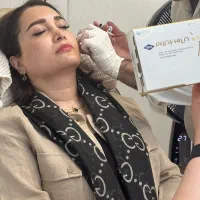 لیزر موهای زائد ،تزریق ژل و بوتاکس،هایفوتراپی