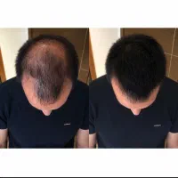 با این روش خداحافظی کن با کمپشتی