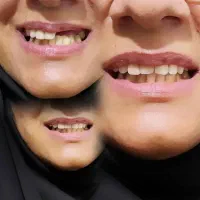 دندان سازی(برای راحتی شما از یزد به شیراز اومدیم)