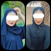 پک تپلی صورت صد درصد تضمینی