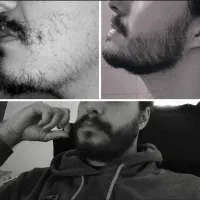 ریشات از موهاتم پرپشت تر میشه