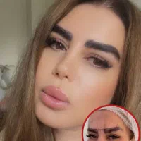 کاشت ابرو (تهران)