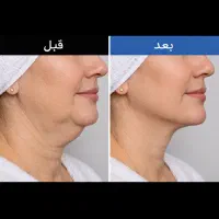 جوانسازی و‌کلاژن سازی پوست