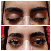 لیفت ابرو و مژه