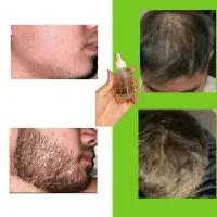 پر پشتی مو و ریش سیبیل