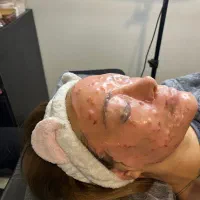 فیشیال تخصصی پوست