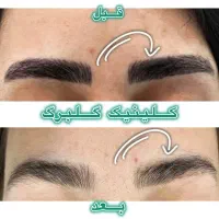 ریموو تتو ابرو و بدن(گلبرگ)