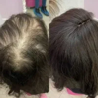 کمکت میکنم از افسردگی در بیای