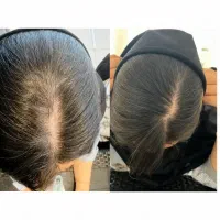 شامپوهای تخصصی دکتر بیز