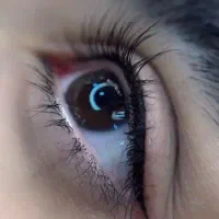 مرکز تخصصی کراتین و تتو صورت