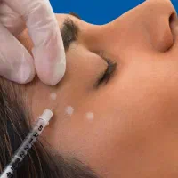 نیازمند مدل بوتاکس پیشانی