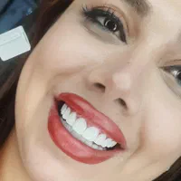 کامپوزیت دندان یاسوج