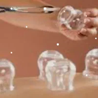 حجامت و بادکش درمانی ،،فقط آقایان. طب سنتی