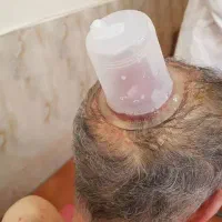 حجامت و ماساژ در محل