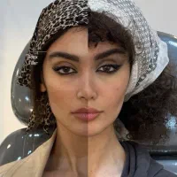 جشنواره فیلر و بوتاکس