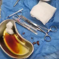 لابیاپلاستی در مشهد