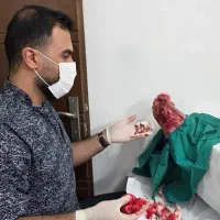 کارشناس تخصصی درمان زخم
