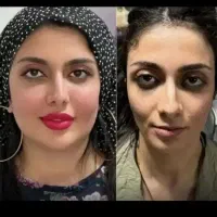 تخفیف ۹۰درصدی ژل باسن و بیکینی هیپ تیپ۹۰تومن