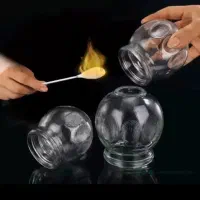 باد کشی حجامت گرم در منزل شما انجام میش