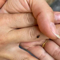 سمپاشی ساس سوسک