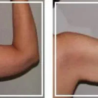 کاهش ۵ تا ۱۰ کیلو در ۱ ماه با ( ورزش ) تضمینی