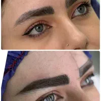 کاشت مو و ابرو اقساطی
