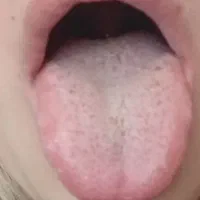 سونوگرافی بدن از روی عکس زبان وتشخیص مزاج