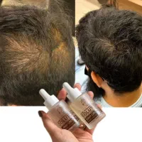 از کم‌پشتی تا پرپشتی تغییر را احساس کنید