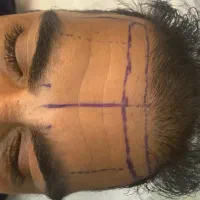 خدمات زیبایی صورت و بدن-اقساط