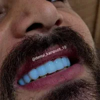کامپوزیت دندان،عصبکشی دندان،روکش و جرمگیری