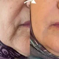 آموزش تخصصی پوست با تخفیف ۵۰ درصدی