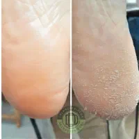پدیکور درمانی و اموزش پدیکور با تخفیف ویژه