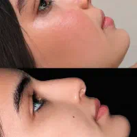 انواع جراحی های زیبایی با قیمت استثنایی
