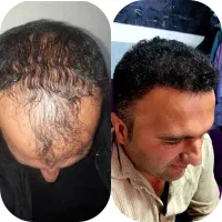 نیازمند پزشک متخصص پوست و‌مو